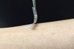 Smart insulin patch to control diabetes