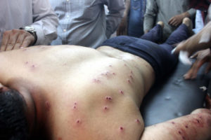 Rajnath Singh’s directive falls on deaf ears, Over 50 civilians hit by pellets in 2 days