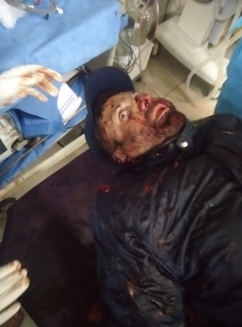 Traffic cop injured when rebels strike in Rajouri Kadal