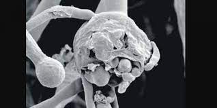 Black Fungus Vs White Fungus - Cause, Symptoms & Cure