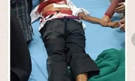 Violence Reaches Disturbing Heights: Two Students Stabbed in Group Clash, a new low in Kashmir
