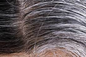Combat Premature Graying of Hair with these Superfoods