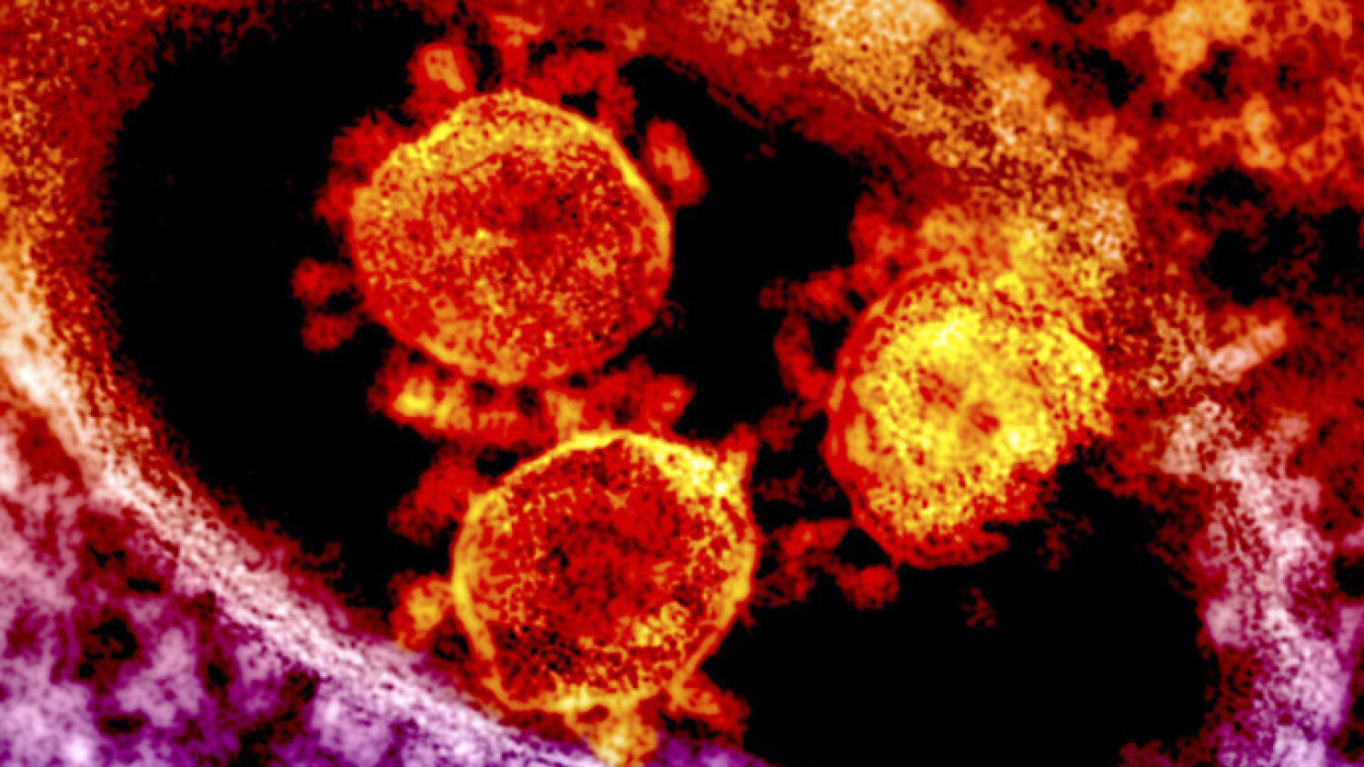 WHO confirms new case of MERS-CoV in Abu Dhabi