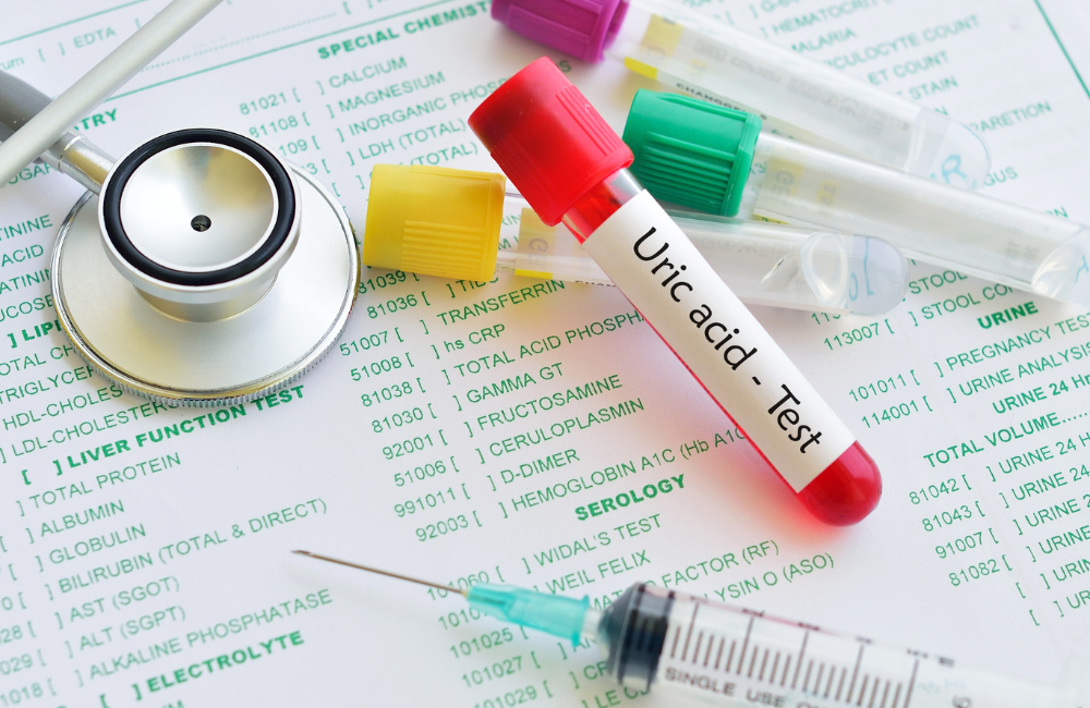 The Unseen Maestro: Mastering the Symphony of Uric Acid Harmony