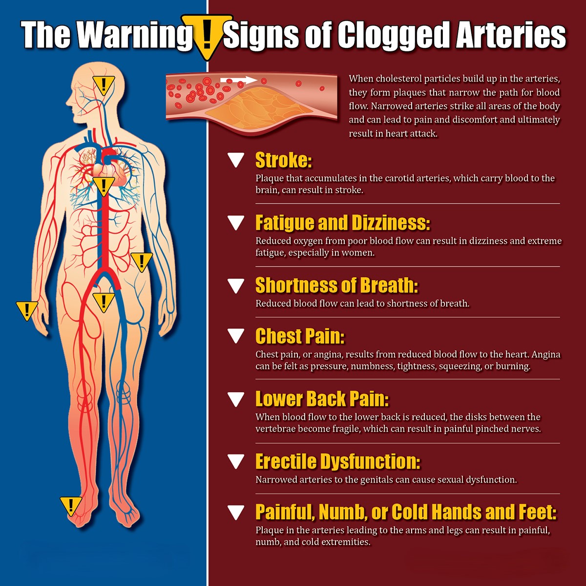 Blocked Heart Arteries: Early Signs, Prevention, Treatment, and Long-Term Wellness