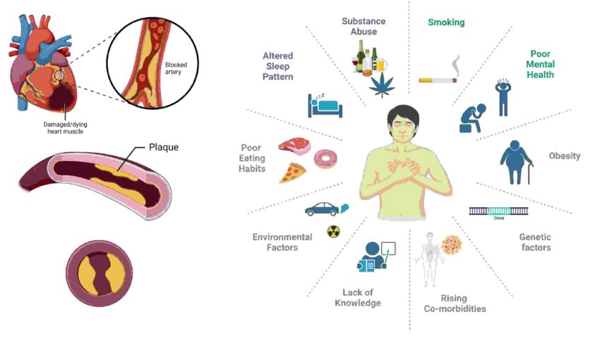 Endless Loop of Heart Tragedies: Genes, Binge Drinking, and Stress Behind Surging Deaths in Young Adults