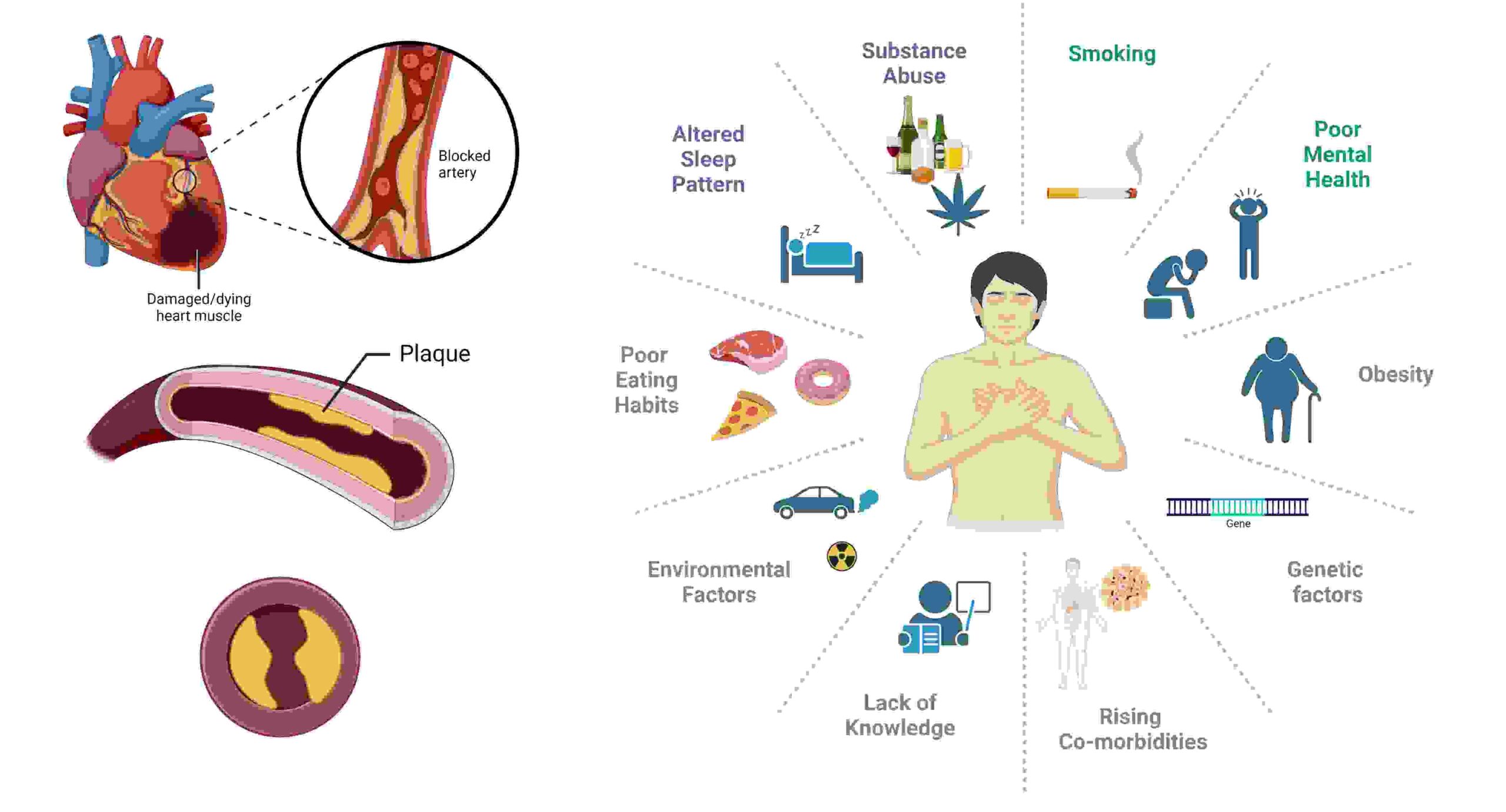 Endless Loop of Heart Tragedies: Genes, Binge Drinking, and Stress Behind Surging Deaths in Young Adults